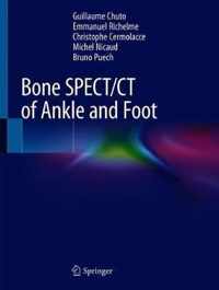 Bone SPECT CT of Ankle and Foot