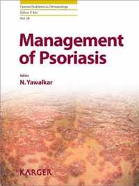 Management of Psoriasis