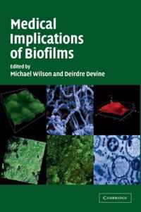 Medical Implications of Biofilms