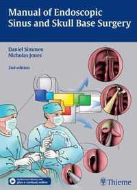 Manual Of Endoscopic Sinus And Skull Base Surgery: And Its E