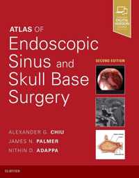 Atlas of Endoscopic Sinus and Skull Base Surgery