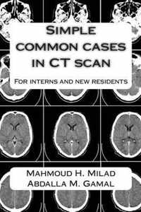 Simple Common Cases in CT Scan