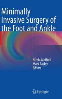 Minimally Invasive Surgery of the Foot and Ankle