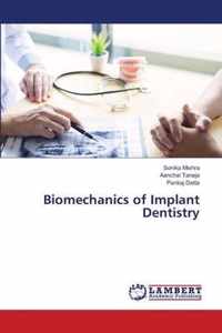 Biomechanics of Implant Dentistry