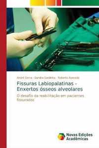 Fissuras Labiopalatinas - Enxertos osseos alveolares