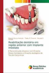 Reabilitacao dentaria em regiao anterior com Implante Imediato