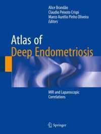 Atlas of Deep Endometriosis