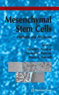 Mesenchymal Stem Cells