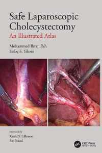 Safe Laparoscopic Cholecystectomy