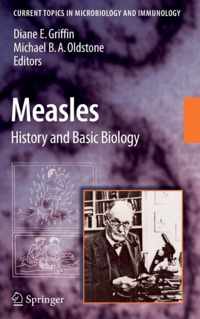 Measles