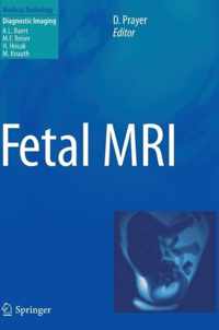 Fetal MRI