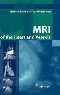 MRI of the Heart and Vessels