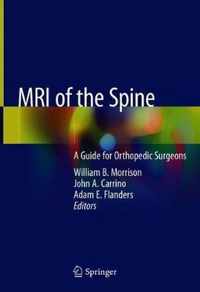 MRI of the Spine