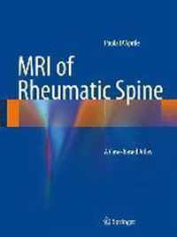 MRI of Rheumatic Spine