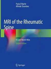 MRI of the Rheumatic Spine