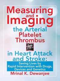 Measuring and Imaging the Arterial Platelet Thrombus in Heart Attack and Stroke