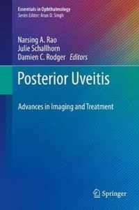 Posterior Uveitis