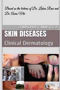 Skin Diseases