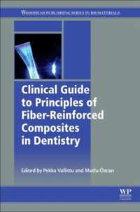 Clinical Guide to Principles of Fiber-Reinforced Composites in Dentistry