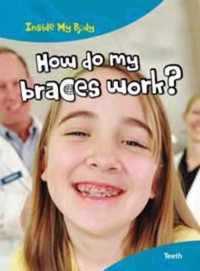 How do my Braces Work?