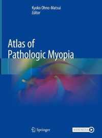 Atlas of Pathologic Myopia