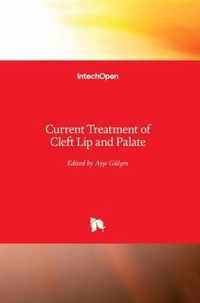 Current Treatment of Cleft Lip and Palate