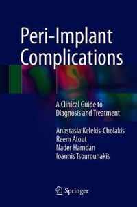 Peri Implant Complications