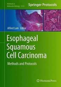 Esophageal Squamous Cell Carcinoma