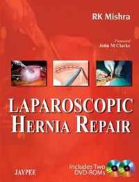 Laparoscopic Hernia Repair