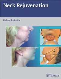 Neck Rejuvenation