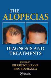 The Alopecias