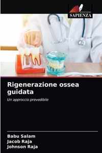 Rigenerazione ossea guidata