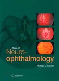 Atlas of Neuro-ophthalmology