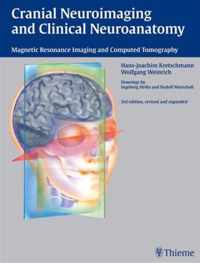 Cranial Neuroimaging and Clinical Neuroanatomy