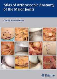 Atlas of Arthroscopic Anatomy of the Major Joints