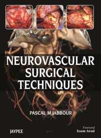 Neurovascular Surgical Techniques