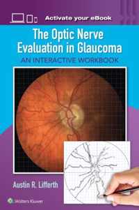 The Optic Nerve Evaluation in Glaucoma