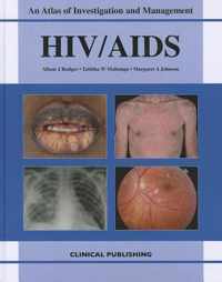 HIV/AIDS