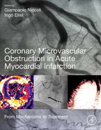 Coronary Microvascular Obstruction in Acute Myocardial Infarction