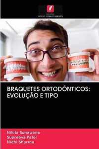 Braquetes Ortodonticos