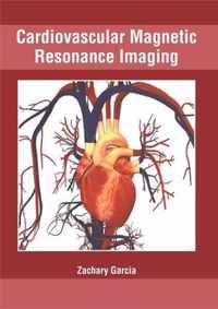 Cardiovascular Magnetic Resonance Imaging