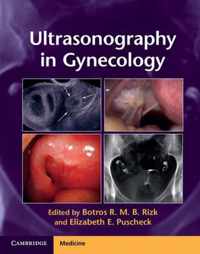 Ultrasonography in Gynecology