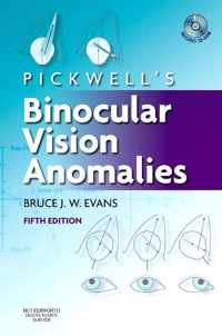 Pickwell's Binocular Vision Anomalies