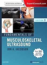 Fundamentals of Musculoskeletal Ultrasound