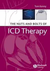 The Nuts and Bolts of ICD Therapy