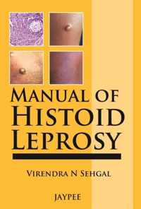 Manual of Histoid Leprosy