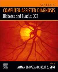 Diabetes and Fundus OCT