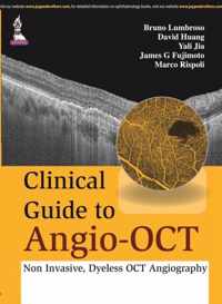 Clinical Guide to Angio-OCT