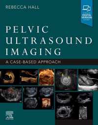 Pelvic Ultrasound Imaging