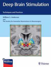 Deep Brain Stimulation